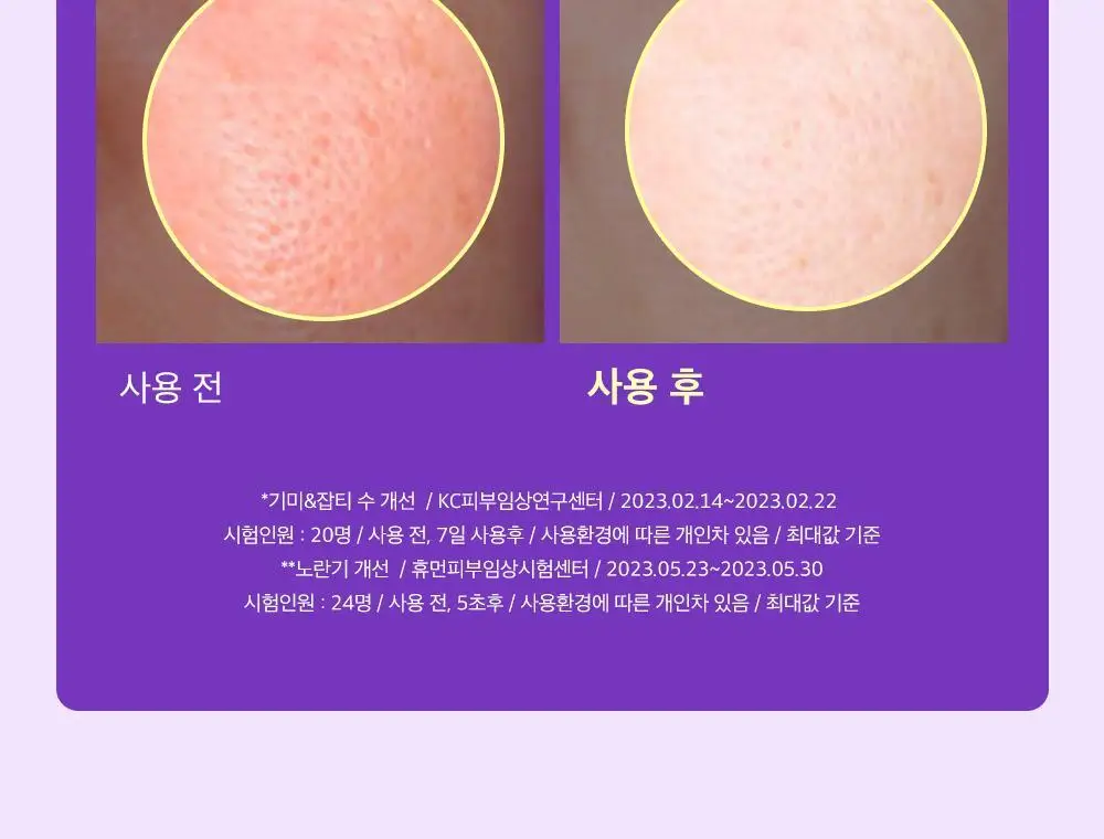 [잡티미백케어] 성분에디터 머루포도 비타씨 다크 스팟 앰플 40ml 더블기획 상세페이지 7